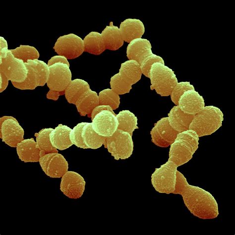 Streptococcus Pneumoniae Bacteria Photograph By Juergen Bergerscience