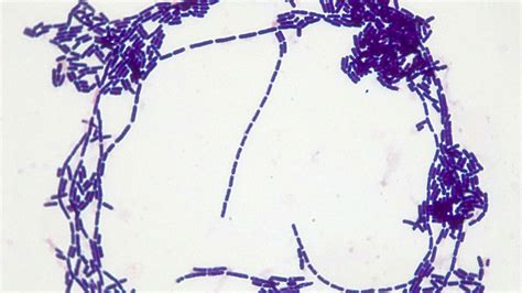Micrograph Bacillus Subtilis Gram Stain 1000x P000010 Oer Commons