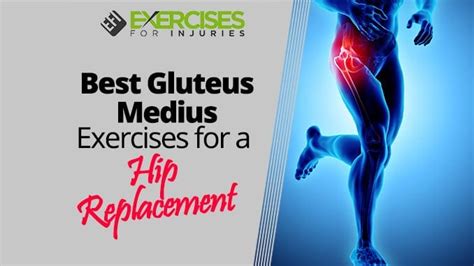 Best Gluteus Medius Exercises For A Hip Replacement Exercises For