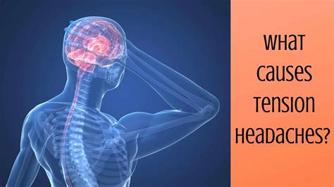 What Causes Tension Headaches Ear Nose And Throat Consultants Llc