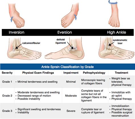 Rosh Review Sprained Ankle Ankle Sprain Grades Sprain Treatment