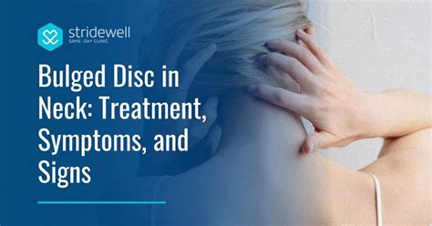 Bulged Disc In Neck Treatment Symptoms And Signs Stridewell