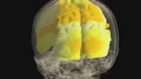 Watch The Worlds First Footage Of A Female Brain During Orgasm