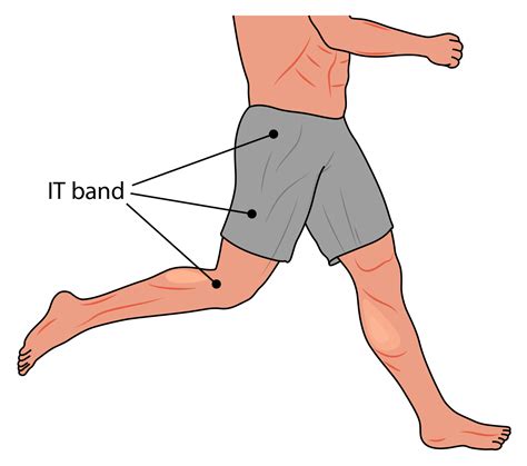It Band And Running Pain Mudgear