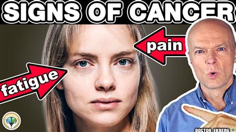 10 Warning Signs Of Cancer You Should Not Ignore Youtube
