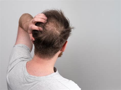 7 Reasons Why Your Hair Is Falling Out And How To Stop It Happy Head
