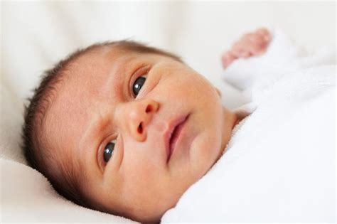 Mata Bayi Kuning Ini Penyebab Dan Cara Mengatasinya