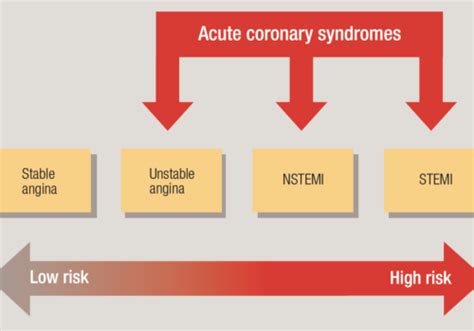 Acute Coronary Syndromes Issues And Answers