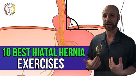 10 best hiatal hernia exercises youtube in 2022 hernia exercises hernia symptoms exercise