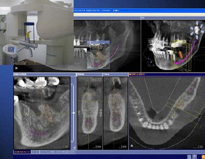 Check spelling or type a new query. 歯科用CTについて ｜ 「市岡歯科医院」公式サイト
