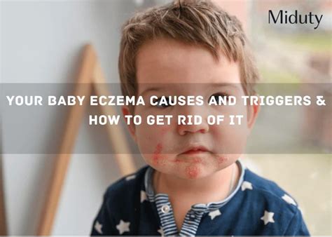 Your Baby Eczema Causes And Triggers And How To Get Rid Of It Miduty