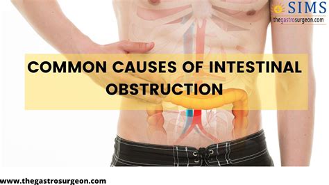 This occurs when your small or large intestine is blocked, and prevents the passage of in case of a serious complication of intestinal obstruction and permanent damage to your bowel, it is required that a surgeon perform a surgical. Common Causes Of Intestinal Obstruction| Intestinal ...