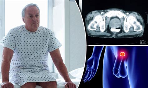 Prostate Cancer Patients With Symptoms Should Have Mri Scans Express