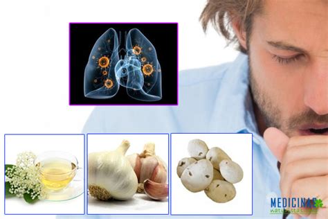 Bronquiectasia Pulmonar Tratamientos Naturales