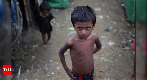 Over 1 Lakh Malnourished Children In Gujarat Govt Ahmedabad News