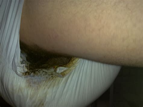 121120111802 In Gallery Diaper Fralda Poop Picture 3