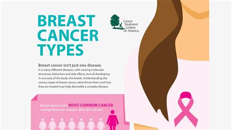 Get information on breast cancer (breast carcinoma) awareness, signs, symptoms, stages, types, treatment, and survival rates. What Are The Different Kinds Of Breast Cancer? Infographic