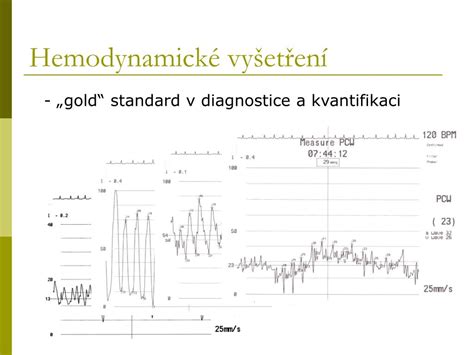 Markery jsou příznaky spojené se zvýšenou pravděpodobností plicní embolie. PPT - Plicní hypertenze a plicní embolie PowerPoint ...