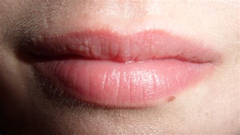 Immunization with the antirabic vaccine b. Small White Bumps on Lips - Causes and Treatment
