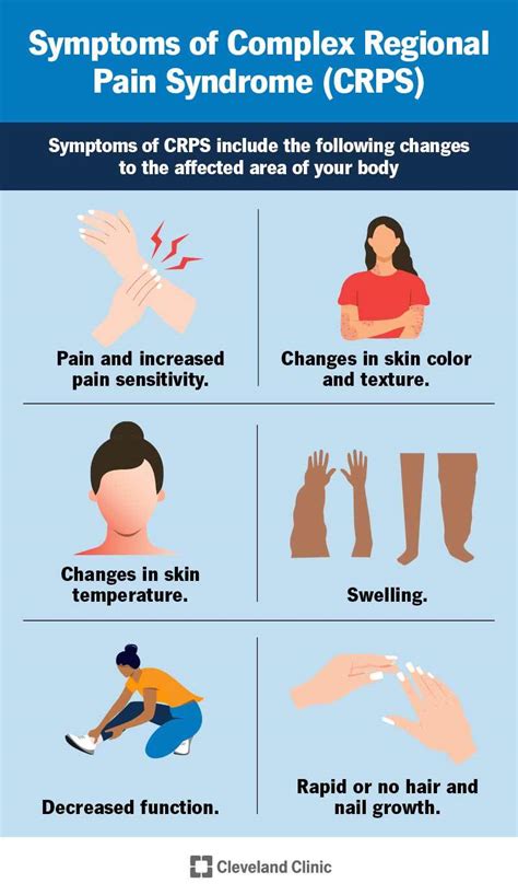 Top 9 What Is The Best Treatment For Crps 2022