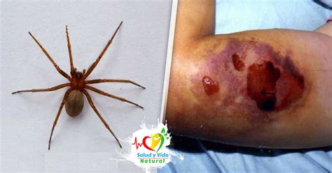 La presencia de dicha araña en méxico se confirmó desde hace tres meses, y recientemente ya se han el hábitat natural de la araña violinista son los lugares oscuros, sucios y polvorientos, como. Araña violinista, confirmada como más letal para el ser humano