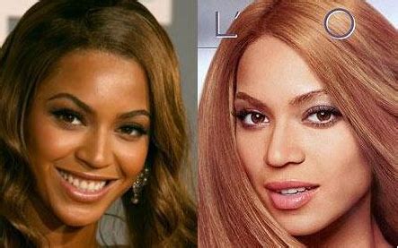 The whole process will leave your hair moisturized after the bleach dried up most of its oil glands. Kojic Acid Skin Lightening, Cream, Soap, Reviews and Side ...