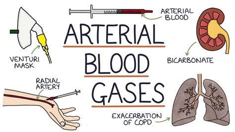 Understanding Arterial Blood Gases Youtube