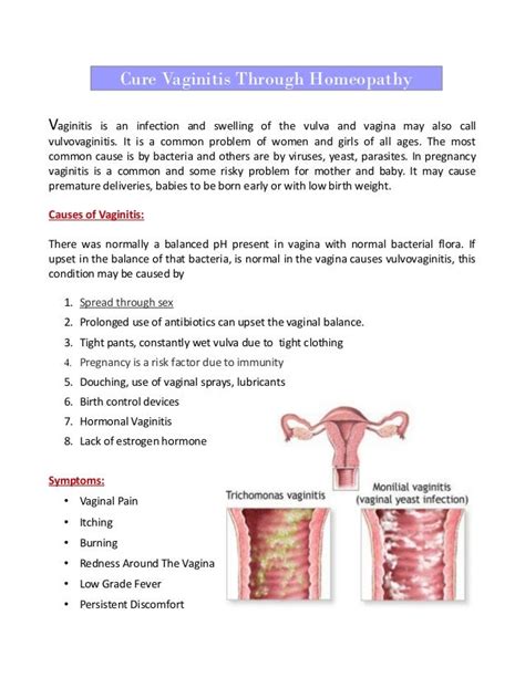 Cure Vaginitis Through Homeopathy