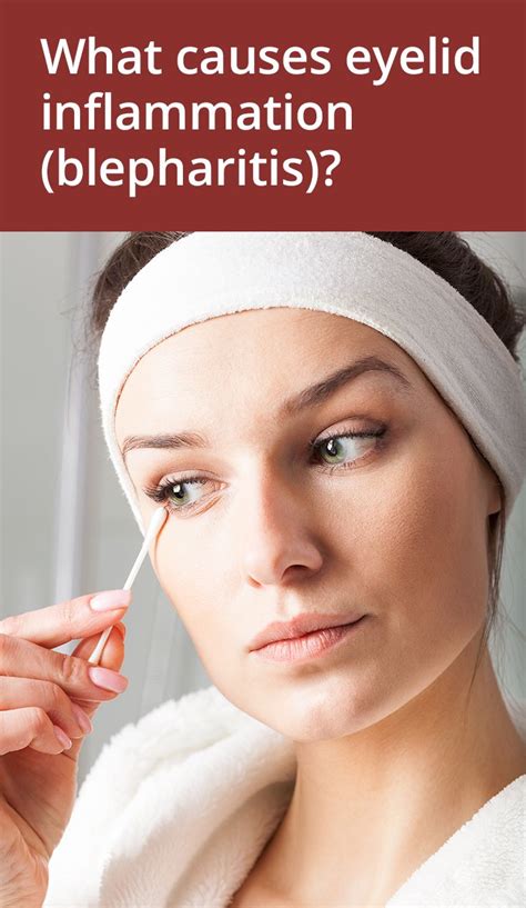 How To Get Rid Of Sore Red Eyelids Blepharitis Blepharitis