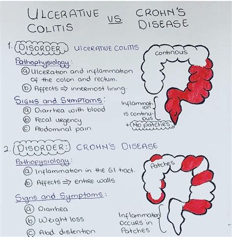 Ulcerative Colitis Vs Crohn S Disease Medizzy