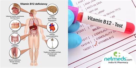 Understanding Vitamin B12 Deficiency Anemia Ask The Nurse Expert