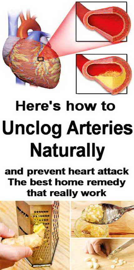 The Best Way To Unclog Arteries Naturally