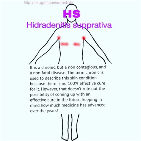 Hidradenitis Hidradenitissupprativa Skindisease The Cure Skin
