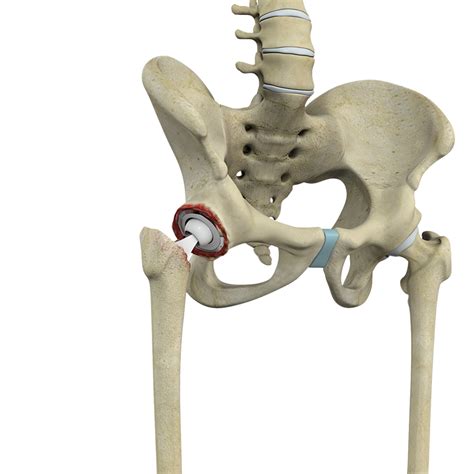 hip surgery memphis hip arthroscopy memphis hip replacement memphis