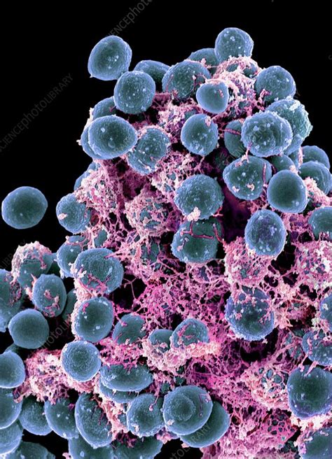 Staphylococcus Epidermidis Bacteria Sem Stock Image C0096307