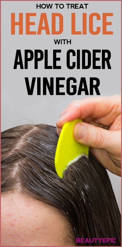 How To Treat Head Lice With Apple Cider Vinegar Apple Cider Vinegar