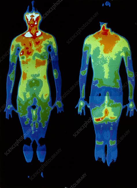 Thermogram Naked Woman Standing Stock Image P Science Photo Library