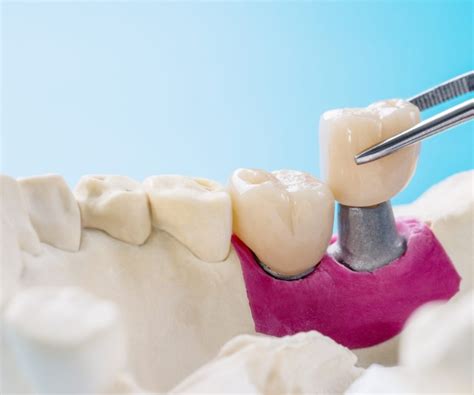 La Carrera De Odontología Según Un Odontólogo