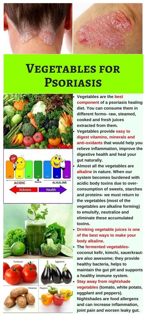 Vegetables Are The Best Ingredients Of A Psoriasis Healing Diet They