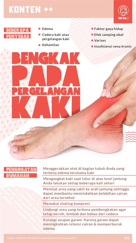 Mengenal Penyebab Bengkak Pada Pergelangan Kaki