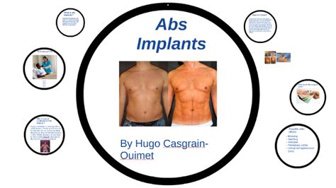 Abdominal Augmentation 6 Pack Implants By Hugo Casgrain Ouimet