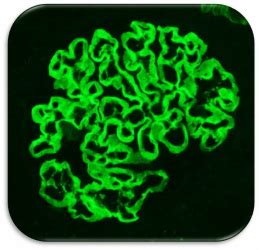 We did not find results for: Nephrotoxic Antisera - Probetex, Inc.