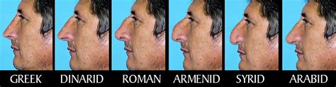 If you do this work out regularly, chances are that in time, the shape of your nose will change, and you will be able. Que tipo de nariz te parece mas fea (fotos) - Página 2 ...