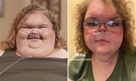 1000 Lb Sisters Star Tammy Slaton 36 Shows Off Her New Look Trendradars