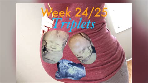 Wk Triplet Pregnancy Update Youtube