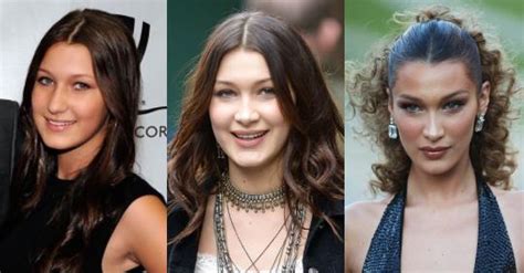 bella hadid s before and after surgery evolution elle australia