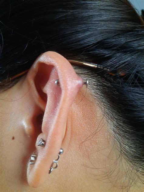 Ear Piercings Infection Bump