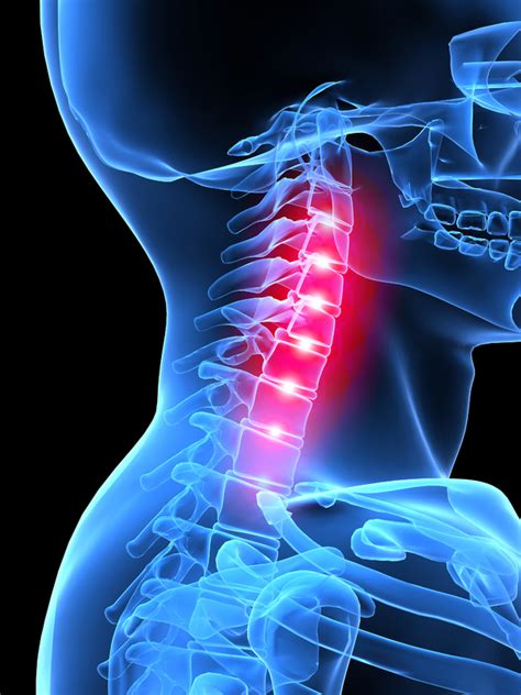 Cervicogenic Dizziness Vestibular Differentiation