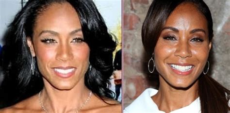 Jada Pinkett Smith Plastic Surgery Before And After Photos