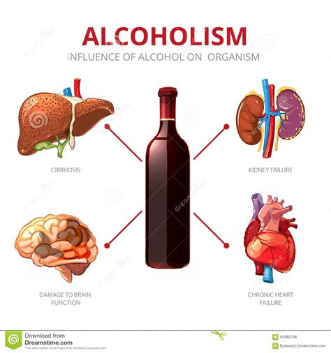 Efectos A Largo Plazo Del Alcohol Vector Del Alcoholismo Ilustración del Vector - Imagen: 64980746
